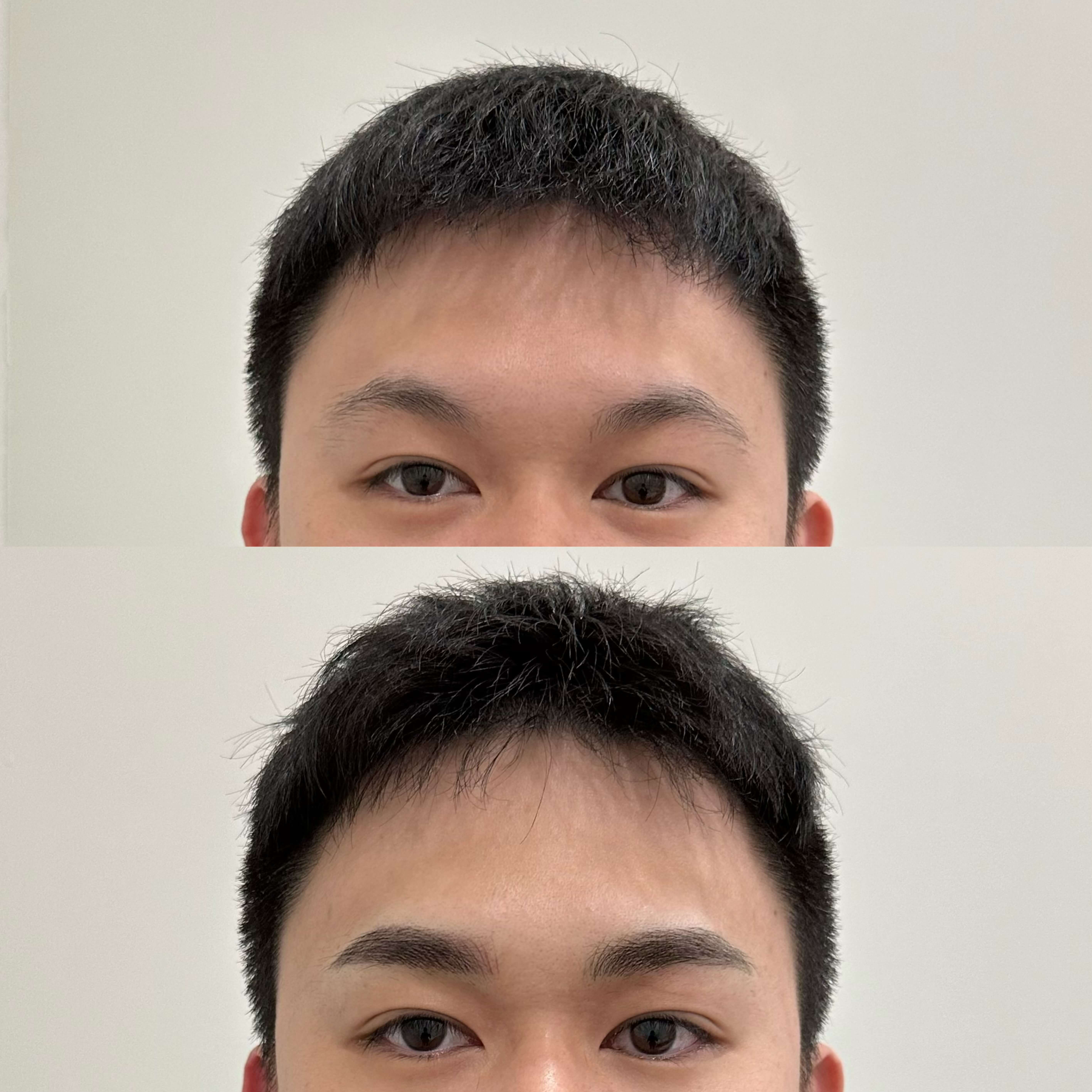 Before After