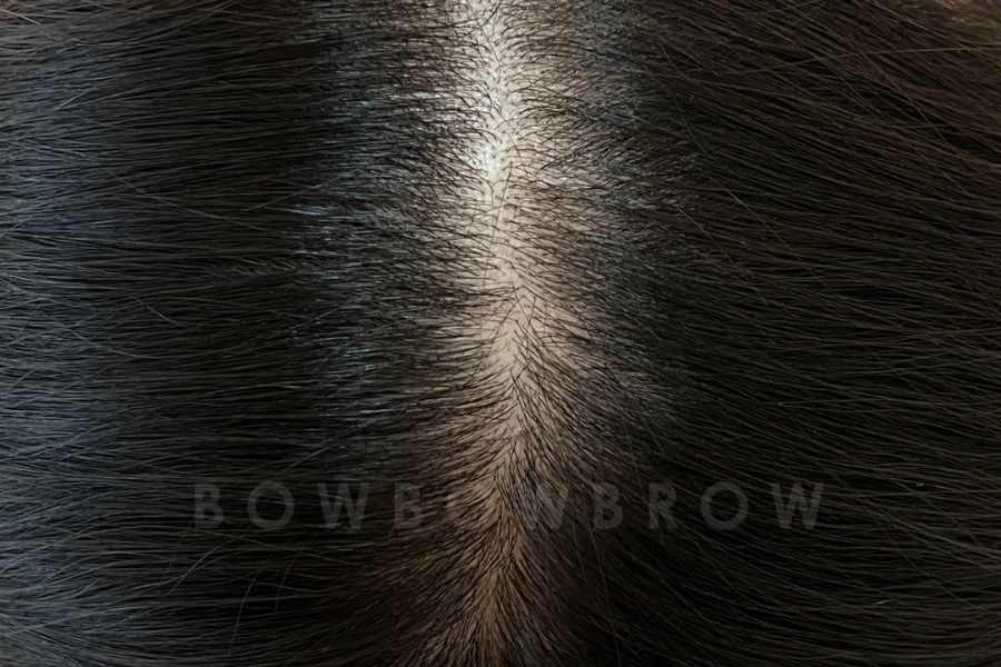 Scalp micropigmentation result through a thinning parting, Bowbowbrow Malaysia