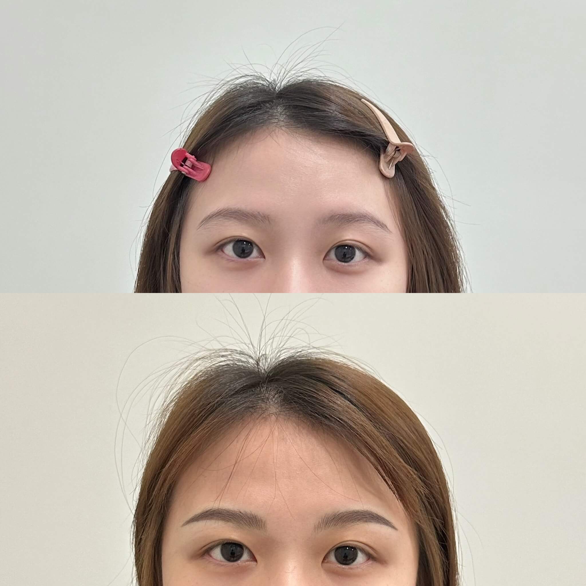 Before After