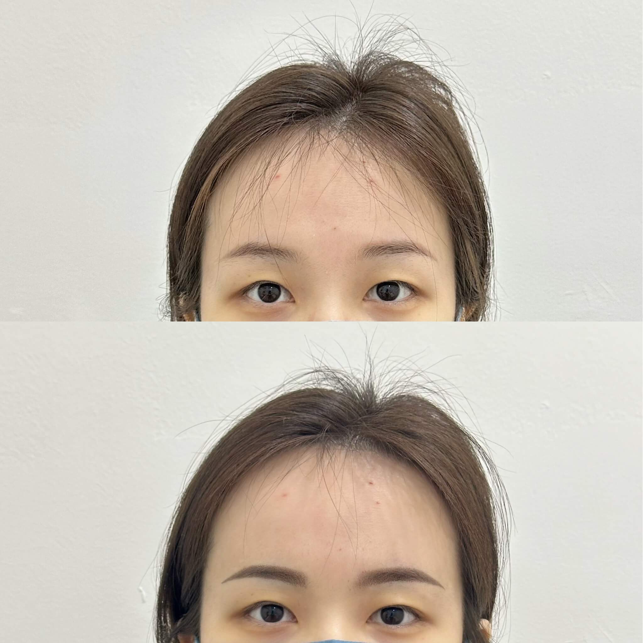 Before After