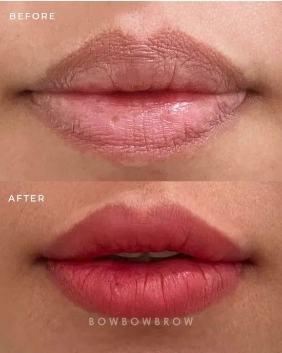 Lips neutralization before and after, dark brown pigmented lips neutralised to an even rose pink, Bowbowbrow Malaysia