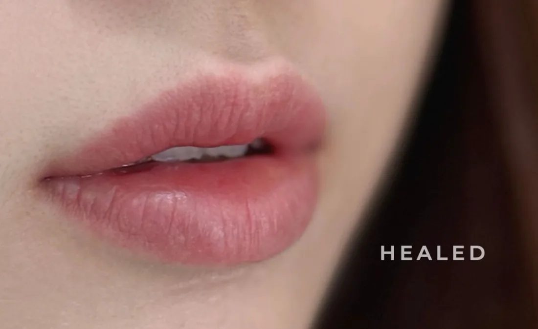Healed lips embroidery, brighter and more even lip colour, Bowbowbrow Malaysia
